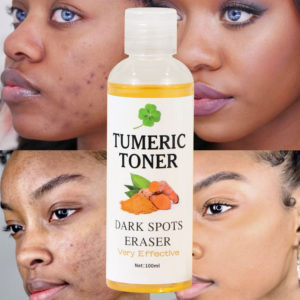 Turmeric Toner dark spot corrector